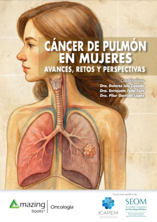 Cáncer de pulmón en mujeres: Avances, retos y perspectivas